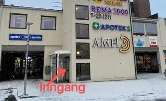 Kinesisk Akupunktur – bilde 1